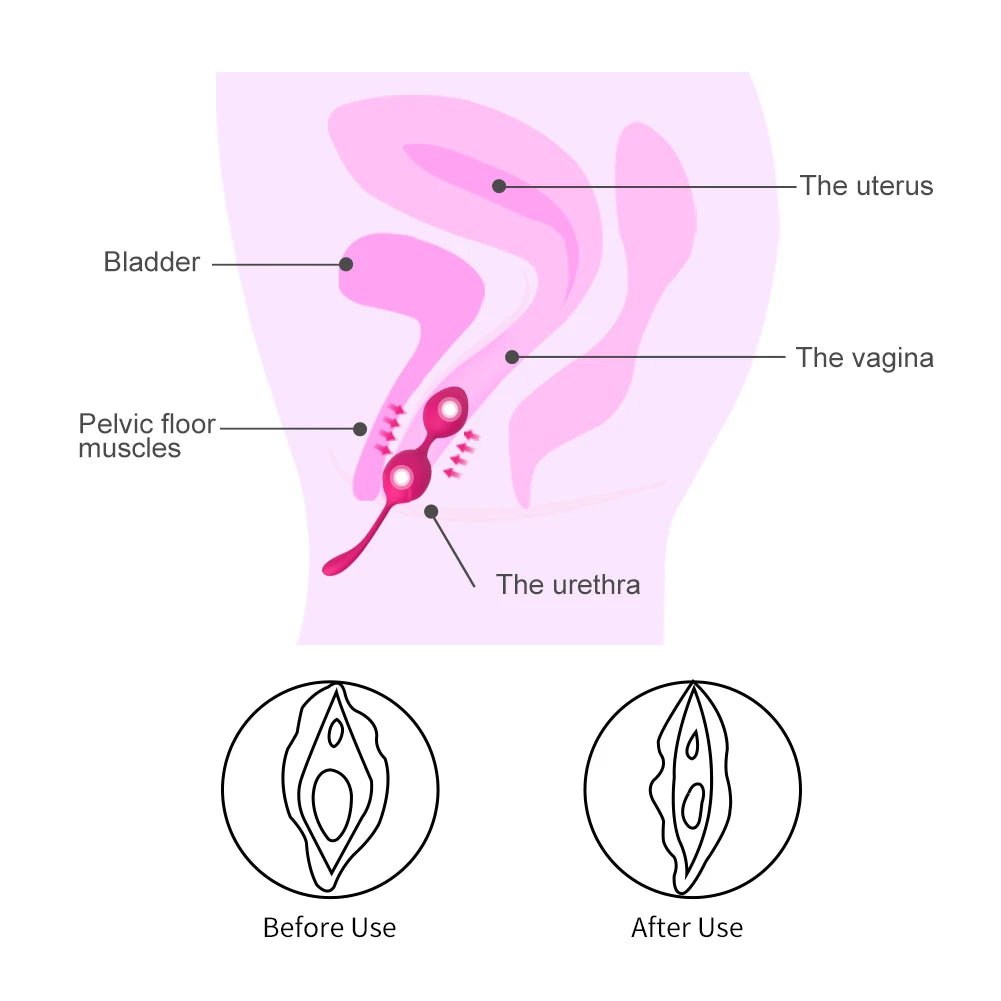 Kegel Balls Silicone Ball Smart Geisha Trainer for Pelvic Health